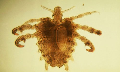 Rận mu - Hình ảnh minh họa